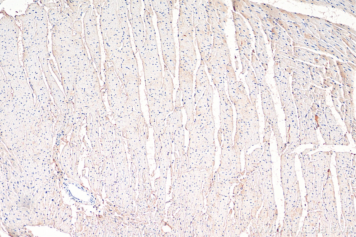 IHC staining of rat heart using 13620-1-AP