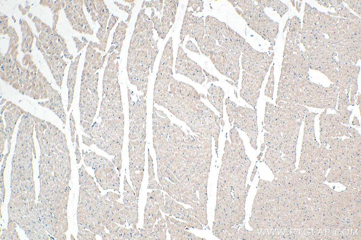 Immunohistochemistry (IHC) staining of rat heart tissue using ST3GAL2 Polyclonal antibody (13620-1-AP)