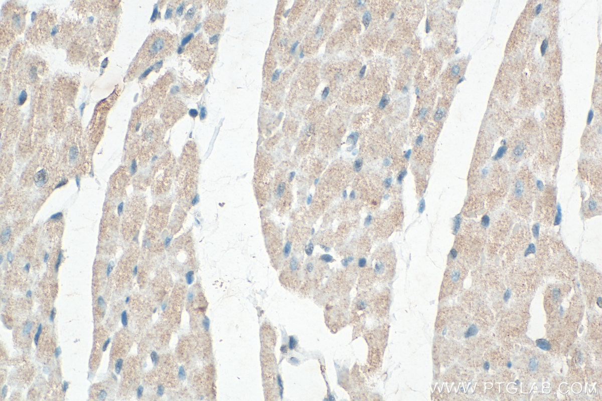 Immunohistochemistry (IHC) staining of rat heart tissue using ST3GAL2 Polyclonal antibody (13620-1-AP)