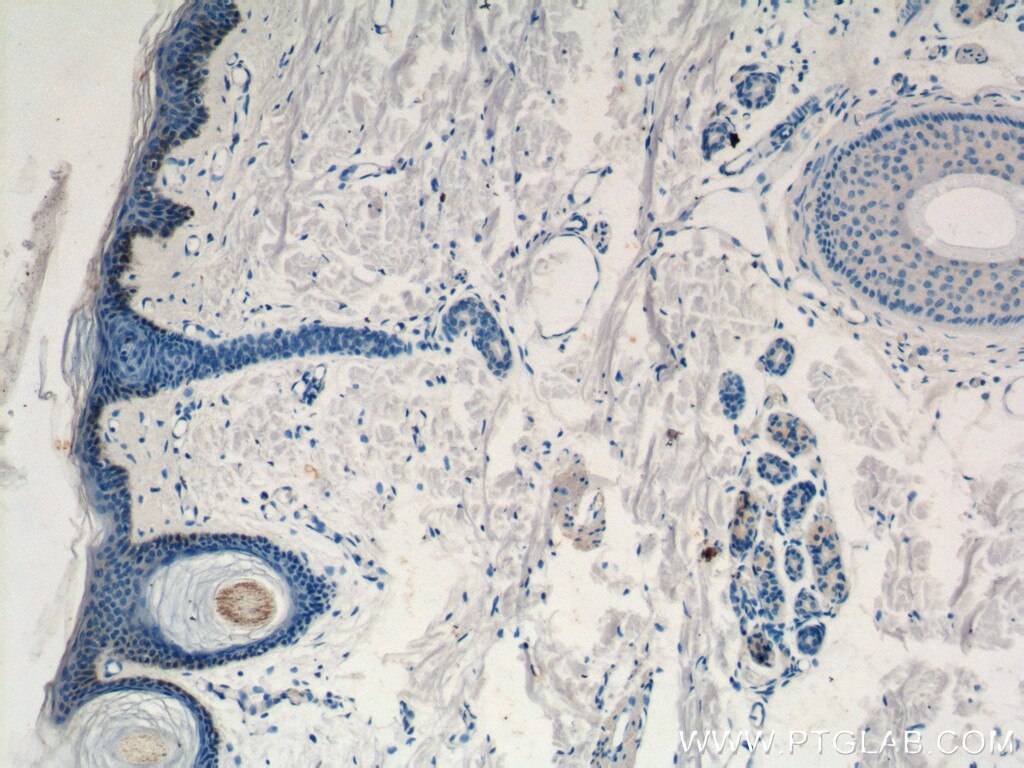 Immunohistochemistry (IHC) staining of human skin tissue using ST3GAL2 Polyclonal antibody (13620-1-AP)