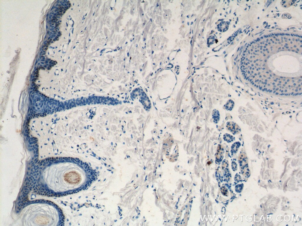 IHC staining of human skin using 13620-1-AP