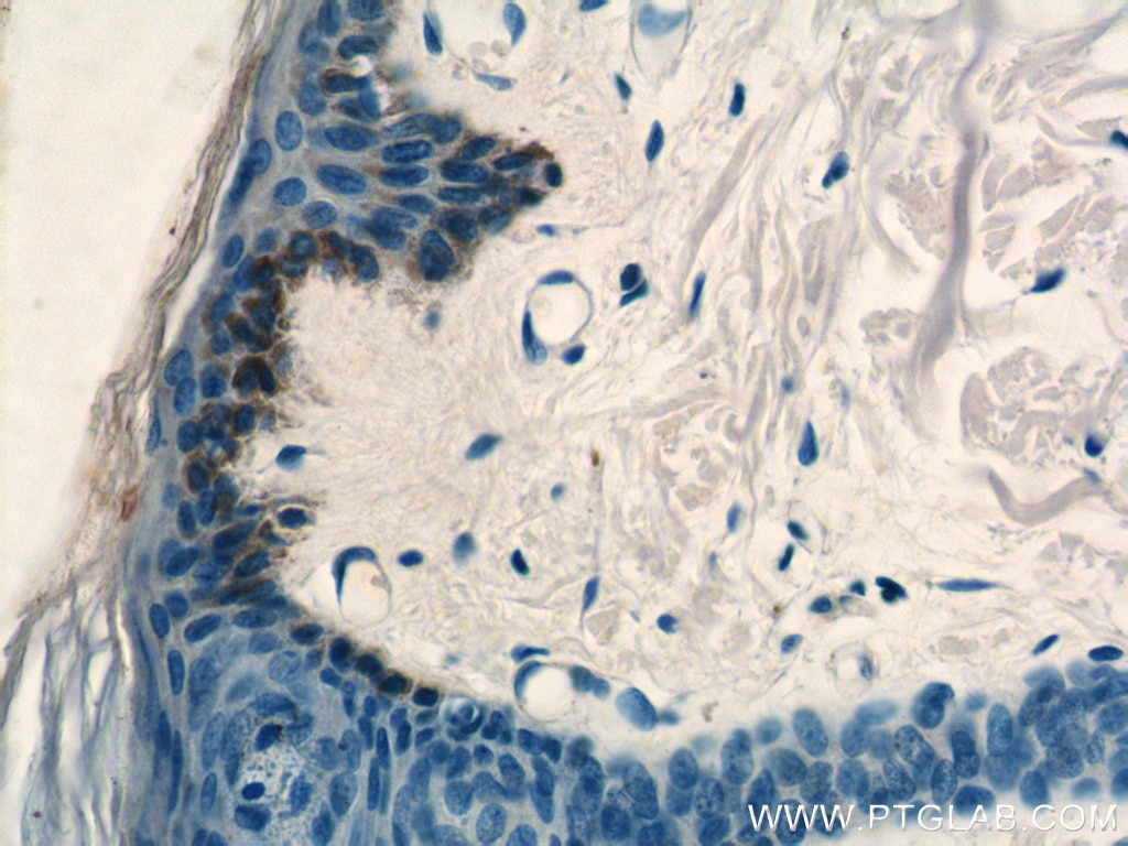 Immunohistochemistry (IHC) staining of human skin tissue using ST3GAL2 Polyclonal antibody (13620-1-AP)