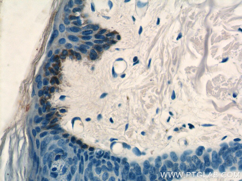 IHC staining of human skin using 13620-1-AP