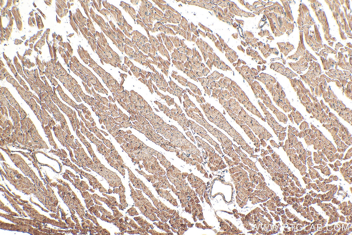 Immunohistochemistry (IHC) staining of mouse heart tissue using ST3GAL2 Polyclonal antibody (13620-1-AP)