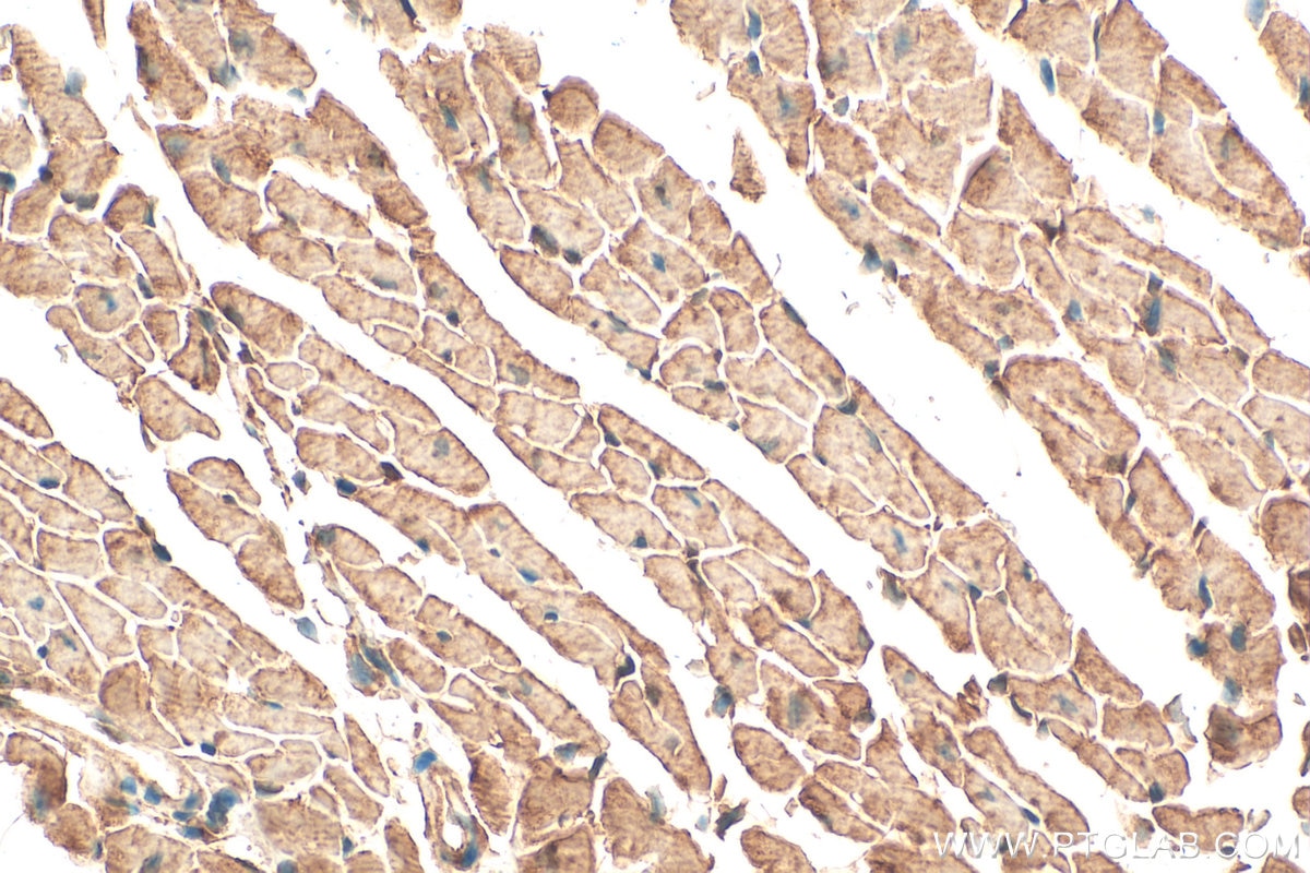 Immunohistochemistry (IHC) staining of mouse heart tissue using ST3GAL2 Polyclonal antibody (13620-1-AP)