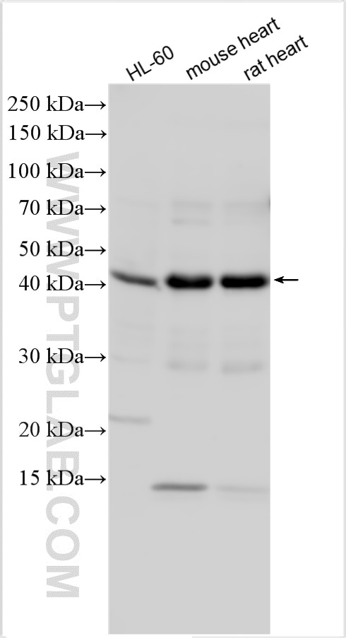 Western Blot (WB) analysis of various lysates using ST3GAL2 Polyclonal antibody (13620-1-AP)