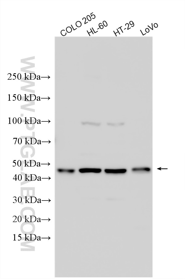Various lysates were subjected to SDS PAGE followed by western blot with 13620-1-AP (ST3GAL2 antibody) at dilution of 1:1000 incubated at room temperature for 1.5 hours. Western Blot (WB) analysis of various lysates using ST3GAL2 Polyclonal antibody (13620-1-AP)
