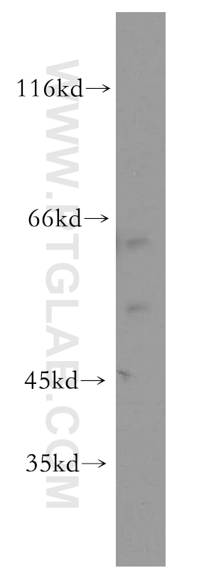 Western Blot (WB) analysis of HL-60 cells using ST3GAL2 Polyclonal antibody (13620-1-AP)