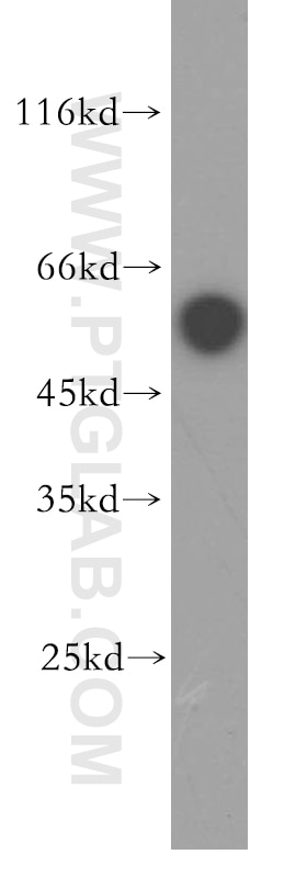 Western Blot (WB) analysis of human liver tissue using ST3GAL2 Polyclonal antibody (13620-1-AP)