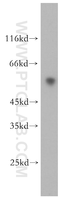 Western Blot (WB) analysis of human heart tissue using ST3GAL2 Polyclonal antibody (13620-1-AP)