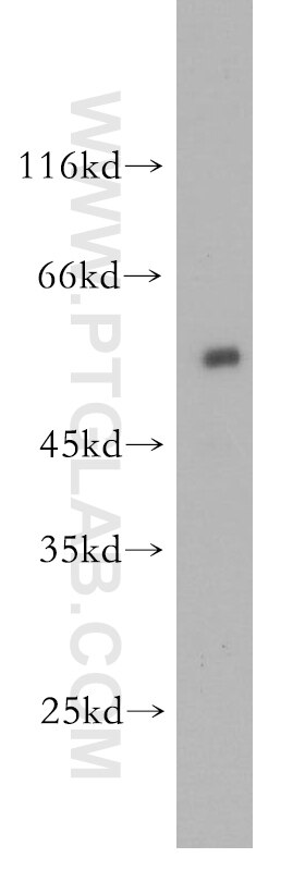 Western Blot (WB) analysis of K-562 cells using ST3GAL2 Polyclonal antibody (13620-1-AP)