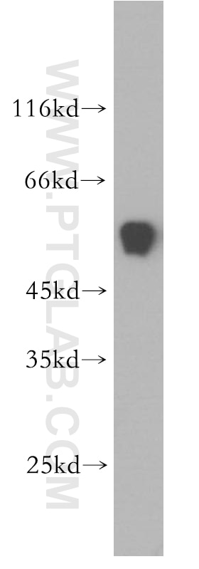 Western Blot (WB) analysis of human spleen tissue using ST3GAL2 Polyclonal antibody (13620-1-AP)