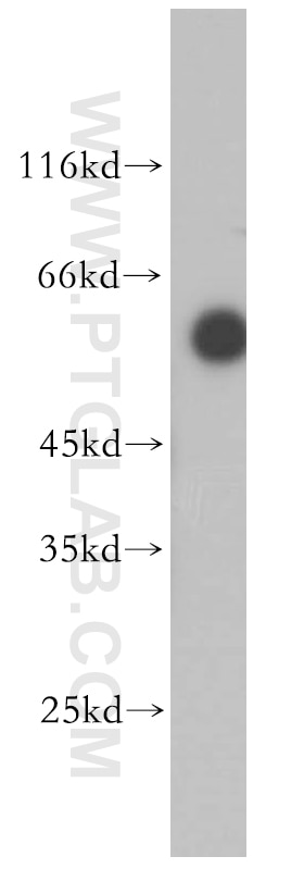 Western Blot (WB) analysis of human colon tissue using ST3GAL2 Polyclonal antibody (13620-1-AP)