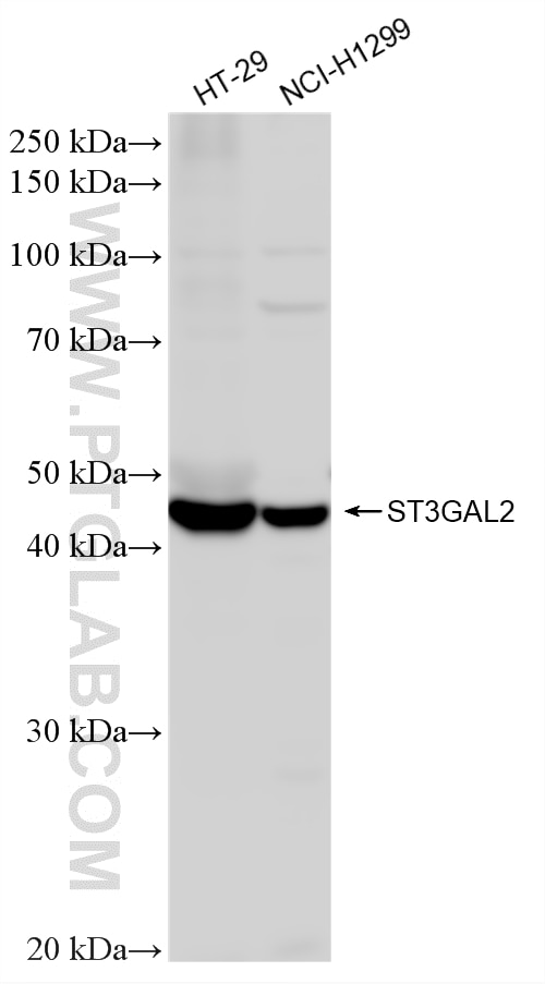 Western Blot (WB) analysis of various lysates using ST3GAL2 Recombinant monoclonal antibody (85634-2-RR)