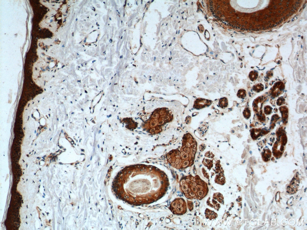 Immunohistochemistry (IHC) staining of human skin tissue using ST3GAL3 Polyclonal antibody (24925-1-AP)