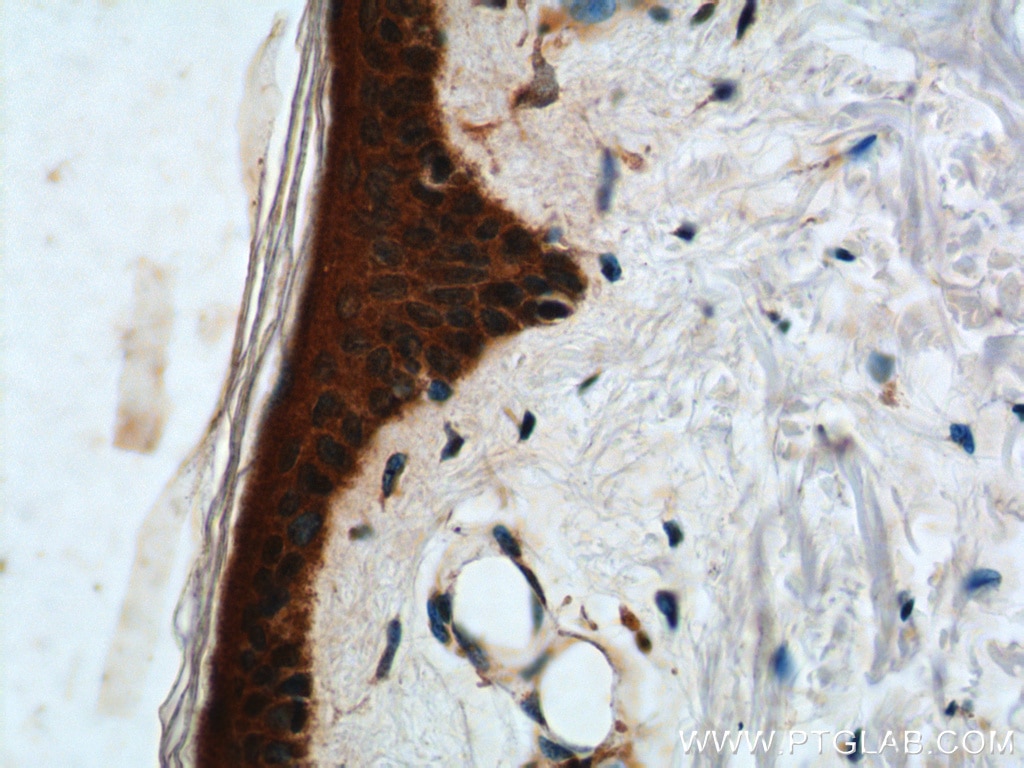 Immunohistochemistry (IHC) staining of human skin tissue using ST3GAL3 Polyclonal antibody (24925-1-AP)