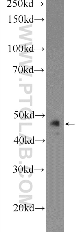 Western Blot (WB) analysis of mouse liver tissue using ST3GAL3 Polyclonal antibody (24925-1-AP)