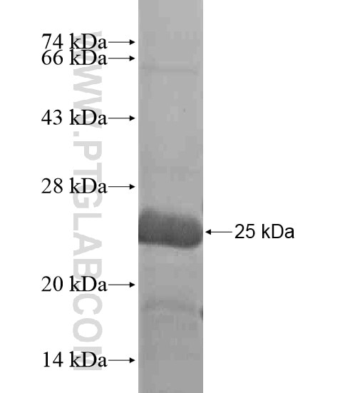 ST3GAL3 fusion protein Ag20795 SDS-PAGE