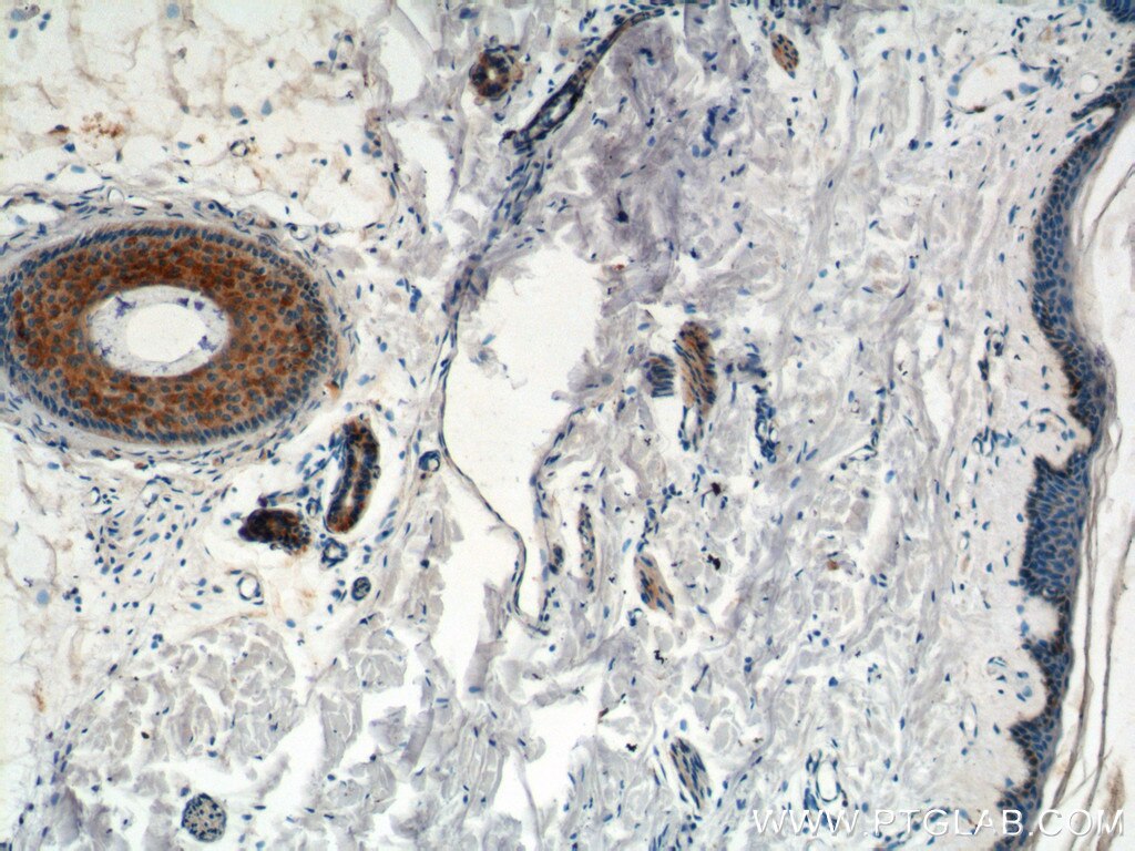 Immunohistochemistry (IHC) staining of human skin tissue using ST3GAL4 Polyclonal antibody (13546-1-AP)