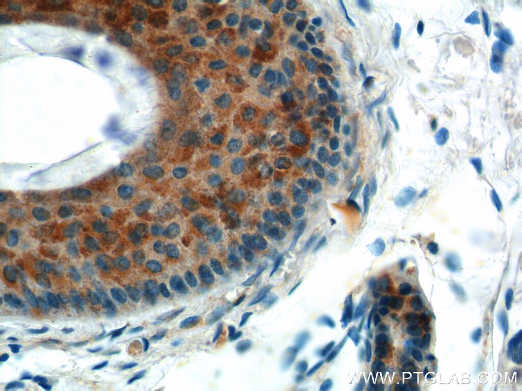 Immunohistochemistry (IHC) staining of human skin tissue using ST3GAL4 Polyclonal antibody (13546-1-AP)