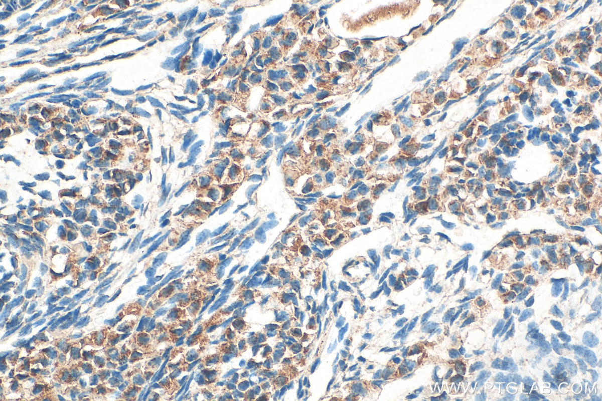 Immunohistochemistry (IHC) staining of mouse ovary tissue using ST3GAL4 Polyclonal antibody (13546-1-AP)