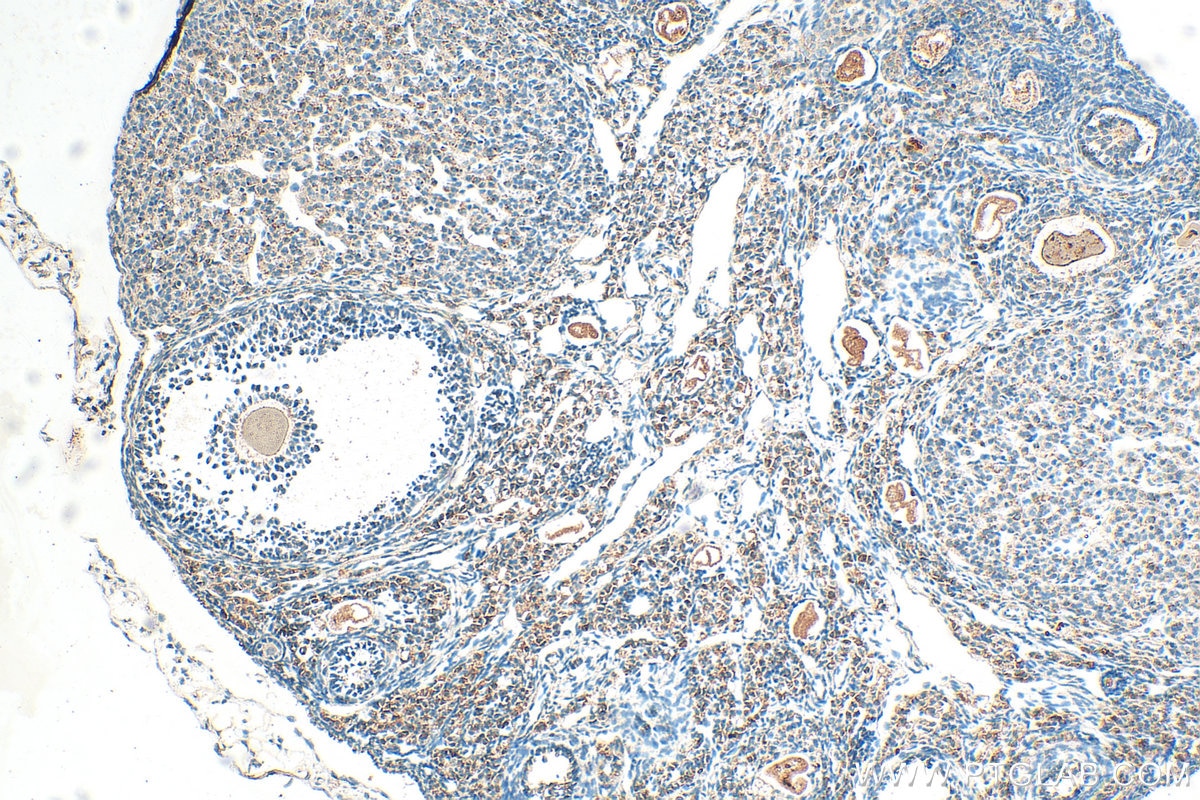 Immunohistochemistry (IHC) staining of mouse ovary tissue using ST3GAL4 Polyclonal antibody (13546-1-AP)