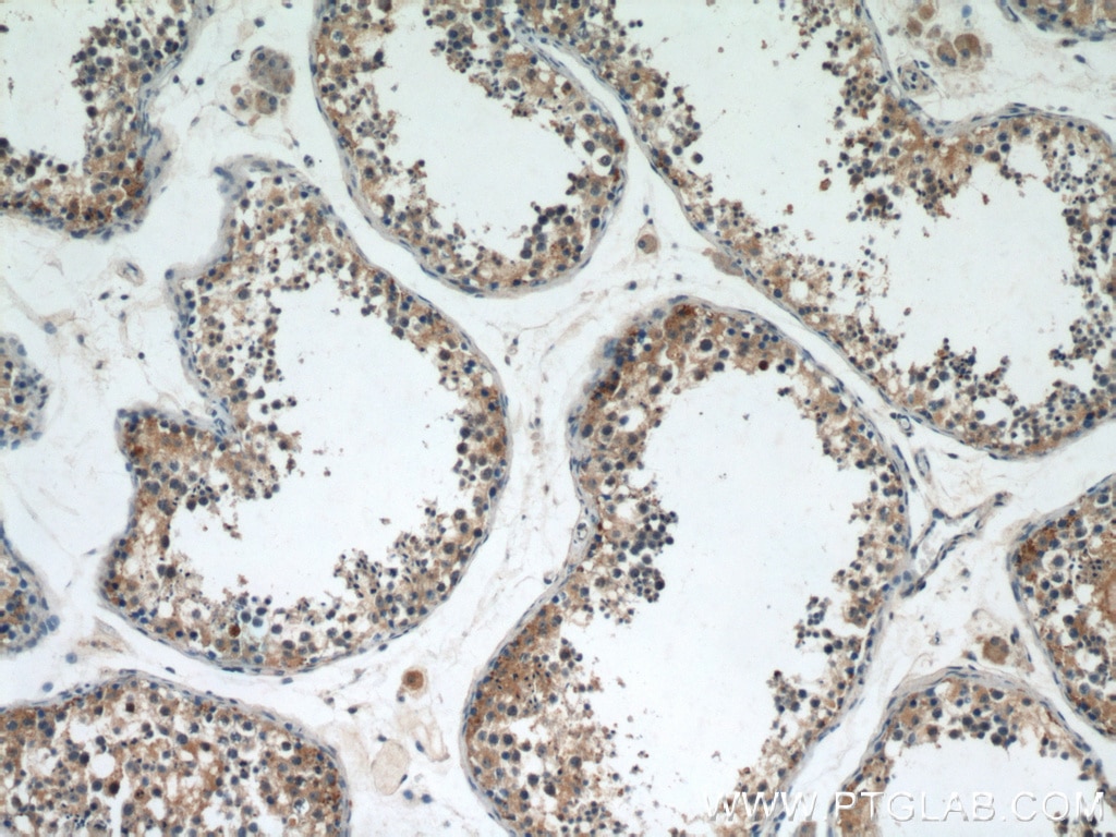 Immunohistochemistry (IHC) staining of human testis tissue using ST3GAL4 Polyclonal antibody (13546-1-AP)