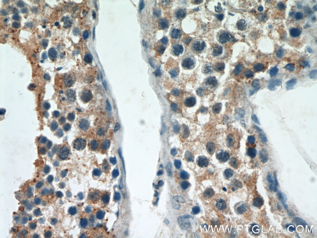 Immunohistochemistry (IHC) staining of human testis tissue using ST3GAL4 Polyclonal antibody (13546-1-AP)