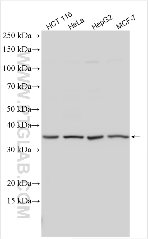 Western Blot (WB) analysis of various lysates using ST3GAL4 Polyclonal antibody (13546-1-AP)