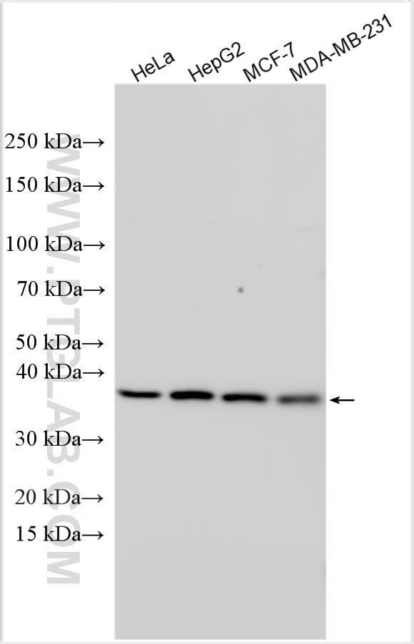 Western Blot (WB) analysis of various lysates using ST3GAL4 Polyclonal antibody (13546-1-AP)