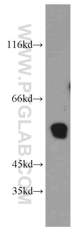 Western Blot (WB) analysis of HeLa cells using ST3GAL4 Polyclonal antibody (13546-1-AP)