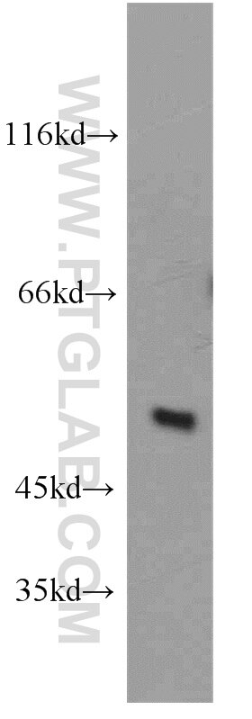 Western Blot (WB) analysis of human testis tissue using ST3GAL4 Polyclonal antibody (13546-1-AP)