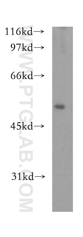 Western Blot (WB) analysis of HEK-293 cells using ST3GAL4 Polyclonal antibody (13546-1-AP)