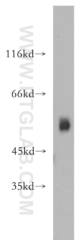 ST3GAL4 Polyclonal antibody