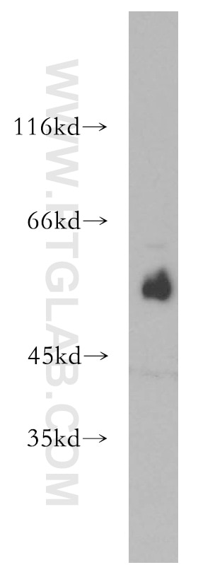 Western Blot (WB) analysis of HepG2 cells using ST3GAL4 Polyclonal antibody (13546-1-AP)