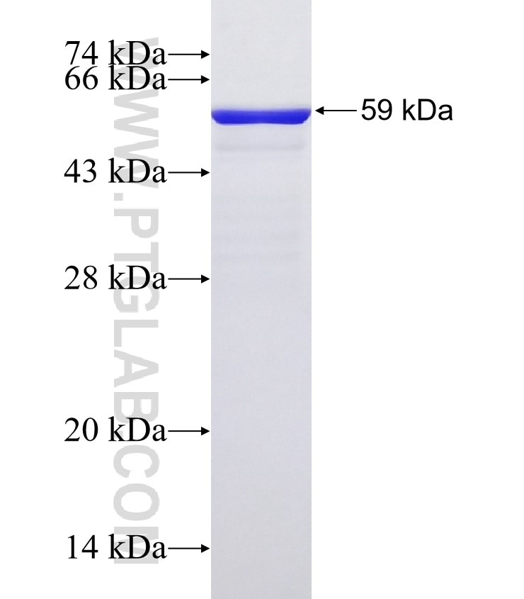 ST3GAL4 fusion protein Ag3665 SDS-PAGE
