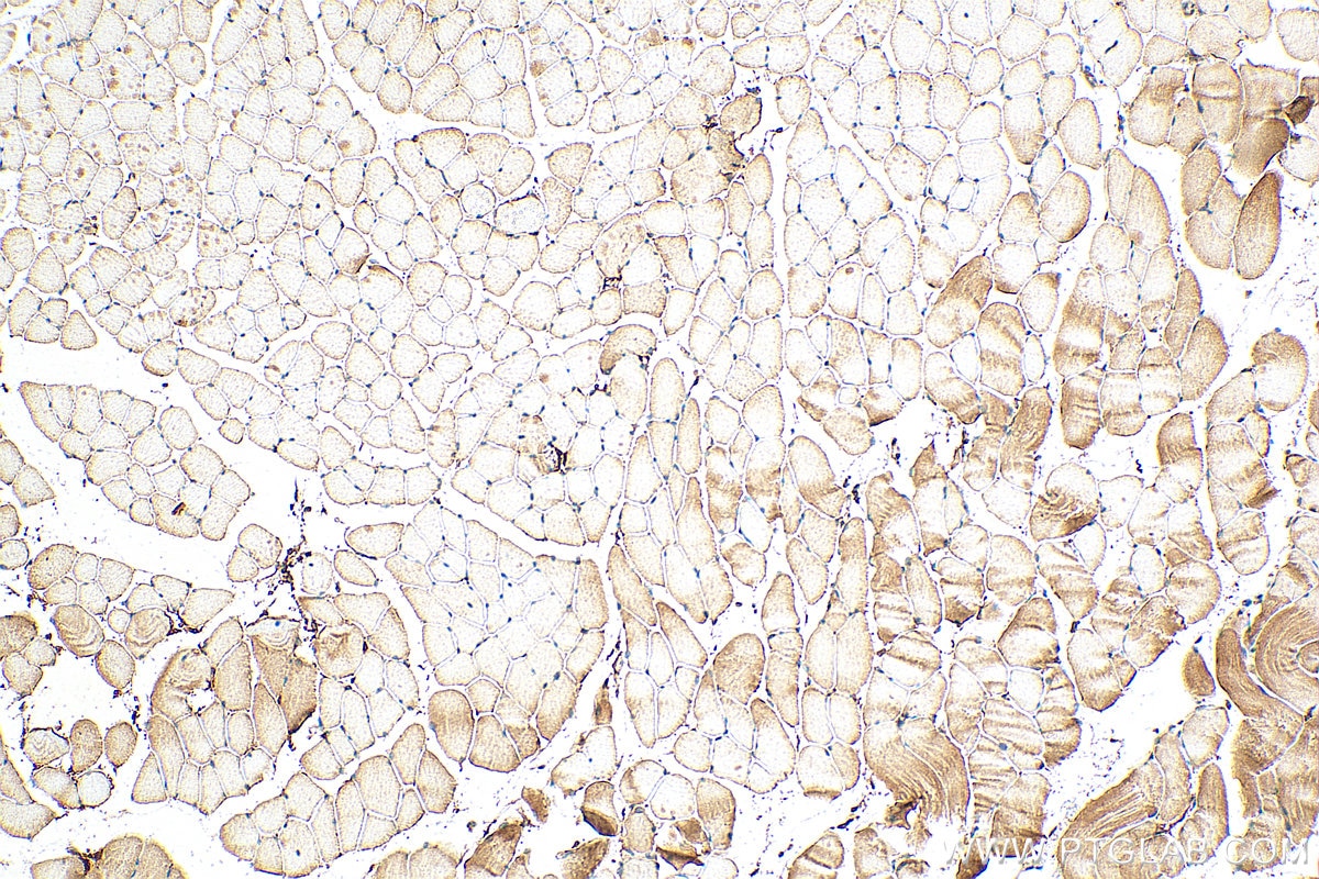 Immunohistochemistry (IHC) staining of mouse skeletal muscle tissue using ST3GAL5 Polyclonal antibody (14614-1-AP)