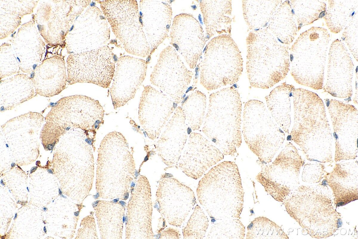 Immunohistochemistry (IHC) staining of mouse skeletal muscle tissue using ST3GAL5 Polyclonal antibody (14614-1-AP)