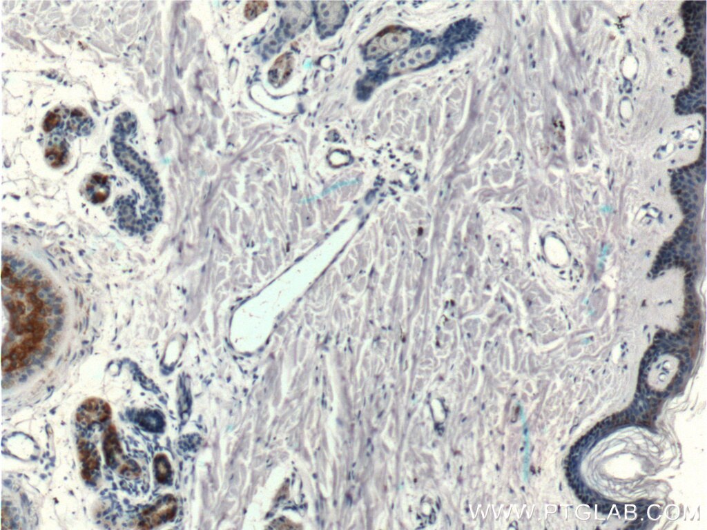 Immunohistochemistry (IHC) staining of human skin tissue using ST3GAL5 Polyclonal antibody (14614-1-AP)