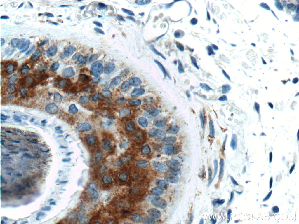 Immunohistochemistry (IHC) staining of human skin tissue using ST3GAL5 Polyclonal antibody (14614-1-AP)