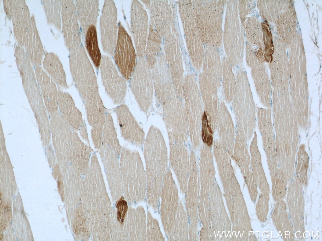 Immunohistochemistry (IHC) staining of human skeletal muscle tissue using ST3GAL5 Polyclonal antibody (14614-1-AP)