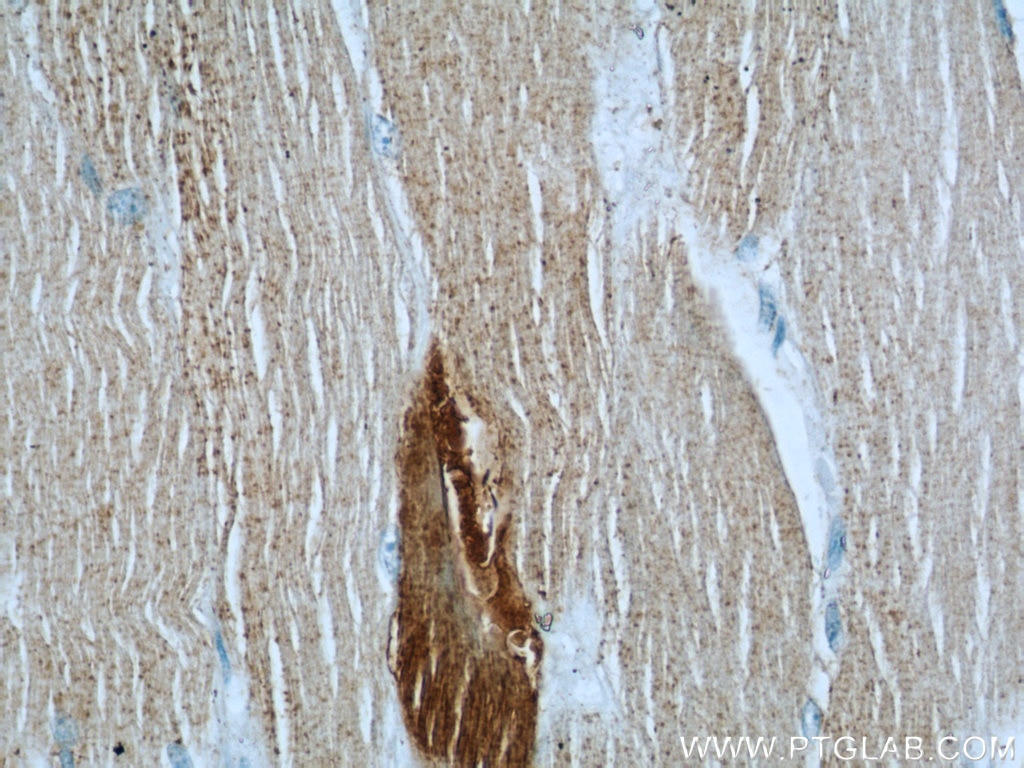 Immunohistochemistry (IHC) staining of human skeletal muscle tissue using ST3GAL5 Polyclonal antibody (14614-1-AP)