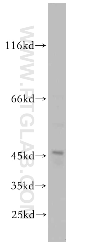 Western Blot (WB) analysis of Jurkat cells using ST3GAL5 Polyclonal antibody (14614-1-AP)