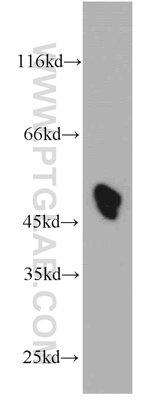 Western Blot (WB) analysis of HeLa cells using ST3GAL5 Polyclonal antibody (14614-1-AP)