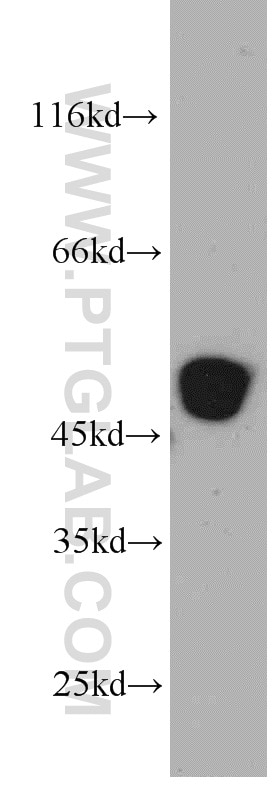 Western Blot (WB) analysis of HEK-293 cells using ST3GAL5 Polyclonal antibody (14614-1-AP)