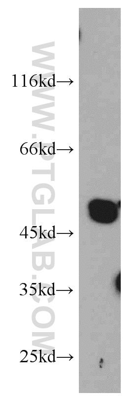 Western Blot (WB) analysis of human testis tissue using ST3GAL5 Polyclonal antibody (14614-1-AP)