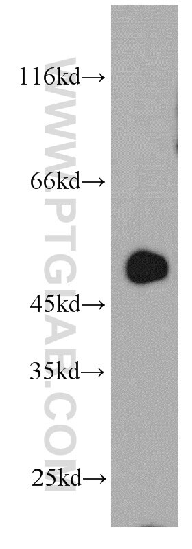 Western Blot (WB) analysis of human placenta tissue using ST3GAL5 Polyclonal antibody (14614-1-AP)