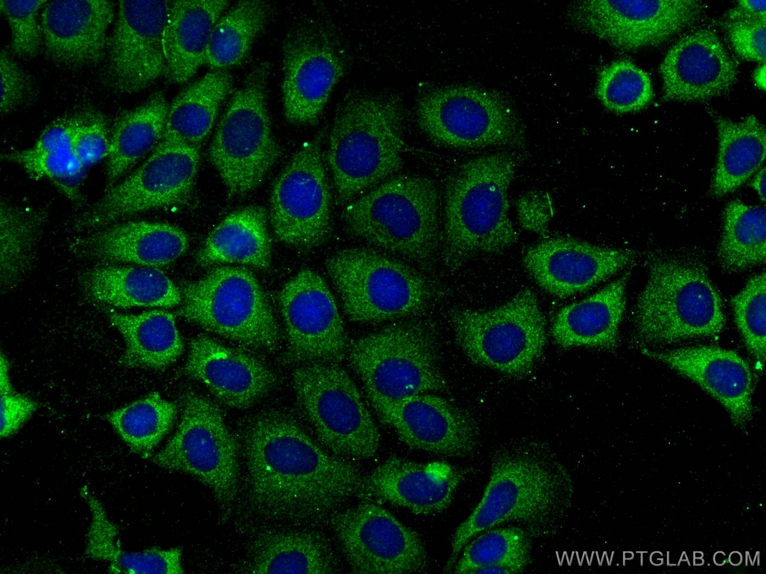 Immunofluorescence (IF) / fluorescent staining of U2OS cells using ST3GAL5 Polyclonal antibody (30120-1-AP)