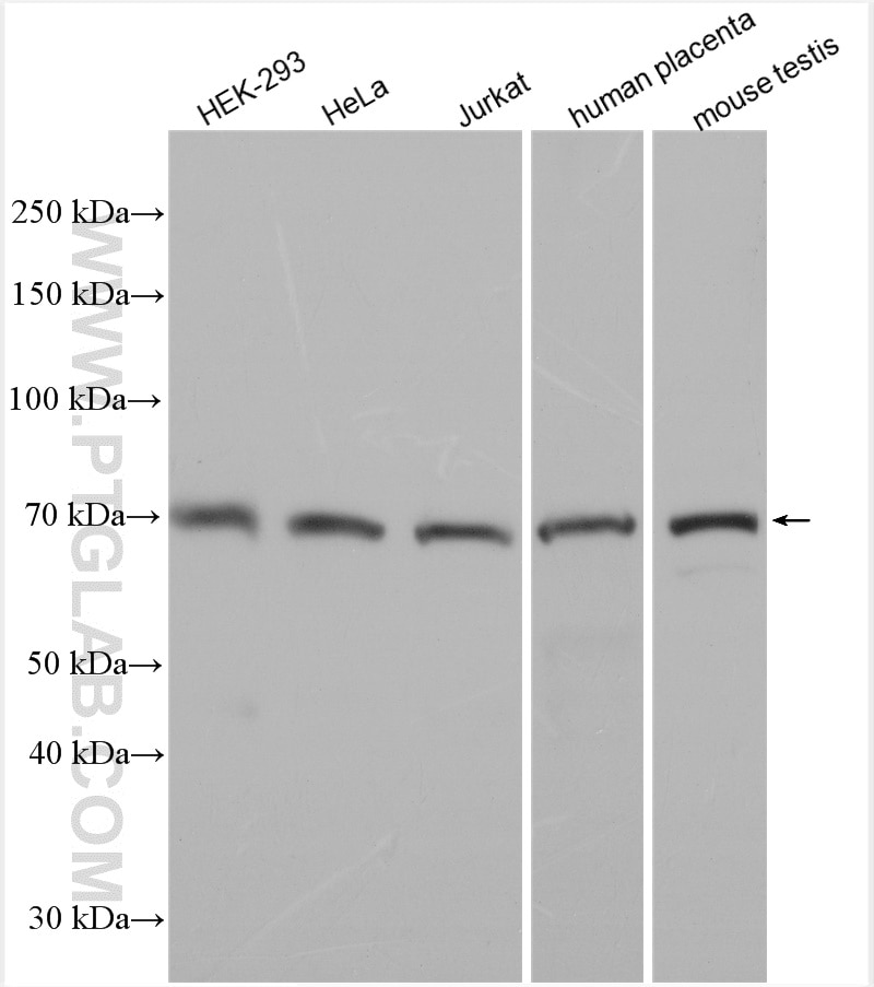 Western Blot (WB) analysis of various lysates using ST3GAL5 Polyclonal antibody (30120-1-AP)
