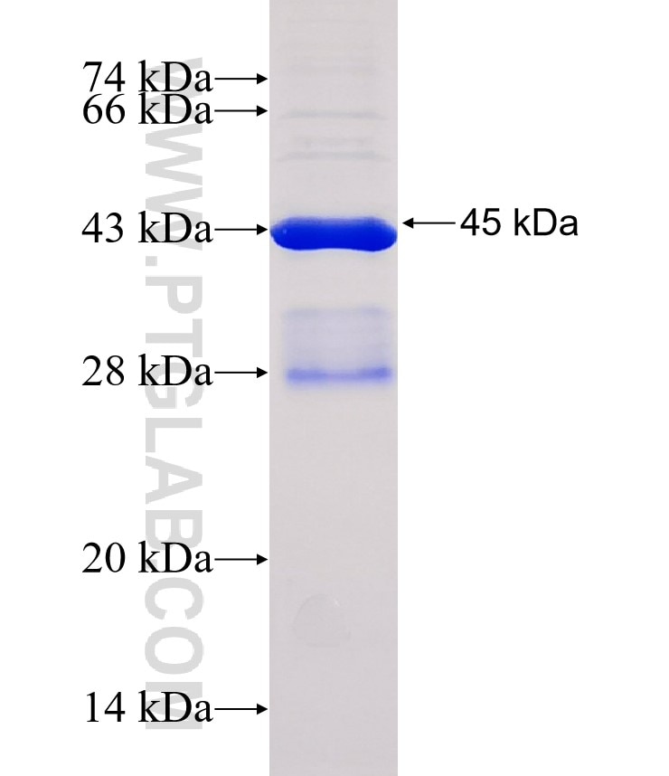 ST3GAL5 fusion protein Ag32461 SDS-PAGE